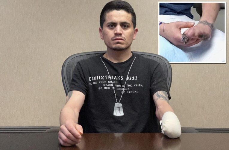 Suspect alleges he was handcuffed so tightly his hand had to be amputated