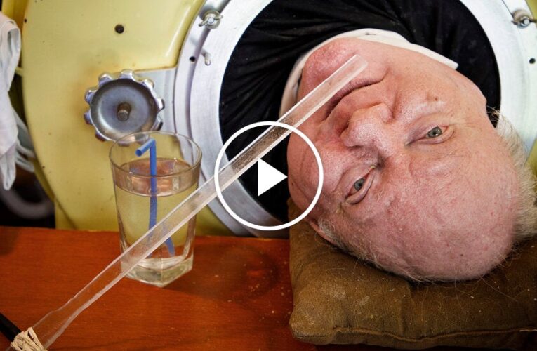 Video: Paul Alexander on Living Inside an Iron Lung
