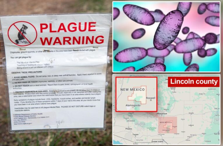 New Mexico man dead from bubonic plague as concerns rise over ‘ongoing risk’ of rodent-borne disease