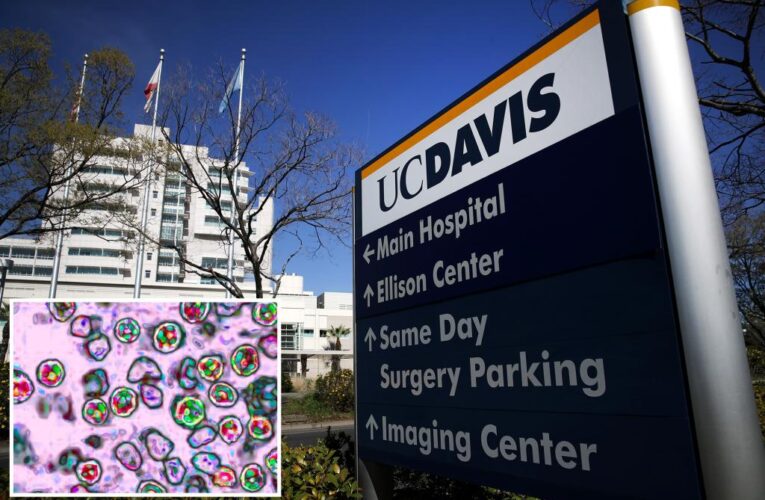 300 people possibly exposed to measles after infected child visits California hospital