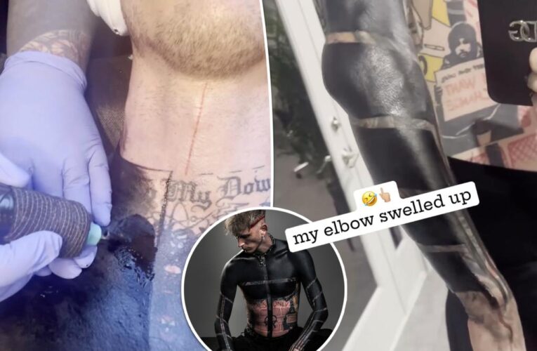 Viral blackout tattoo was ‘most painful s–t I ever experienced’